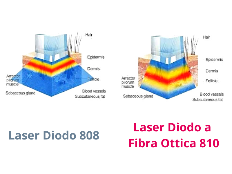 Laser a fibra ottica 810